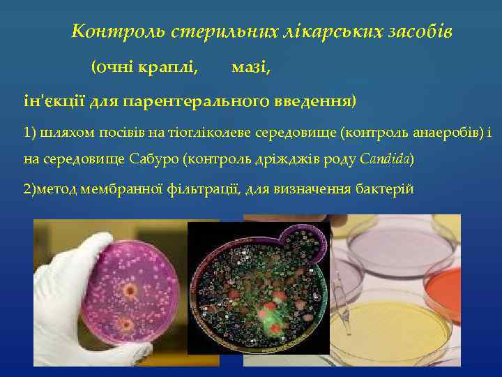 Контроль стерильних лікарських засобів (очні краплі, мазі, ін'єкції для парентерального введення) 1) шляхом посівів