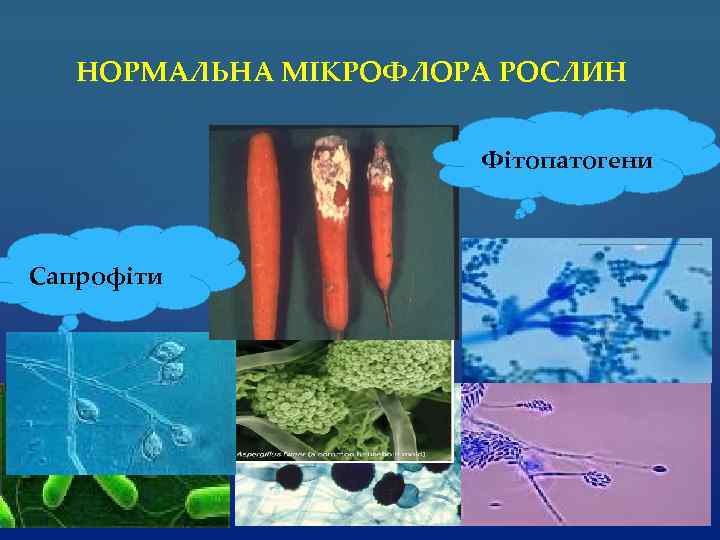 НОРМАЛЬНА МІКРОФЛОРА РОСЛИН Фітопатогени Сапрофіти 