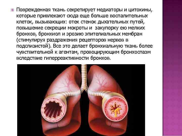  Поврежденная ткань секретирует медиаторы и цитокины, которые привлекают сюда еще больше воспалительных клеток,