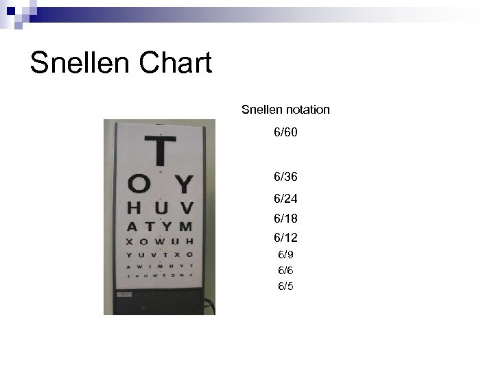 Snellen Chart Snellen notation 6/60 6/36 6/24 6/18 6/12 6/9 6/6 6/5 