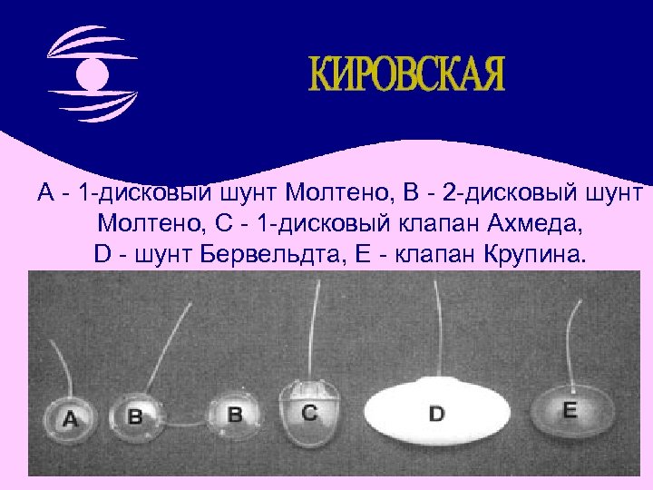 A - 1 -дисковый шунт Молтено, B - 2 -дисковый шунт Молтено, C -