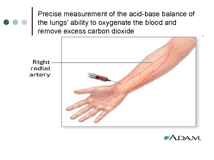 Precise measurement of the acid-base balance of the lungs’ ability to oxygenate the blood