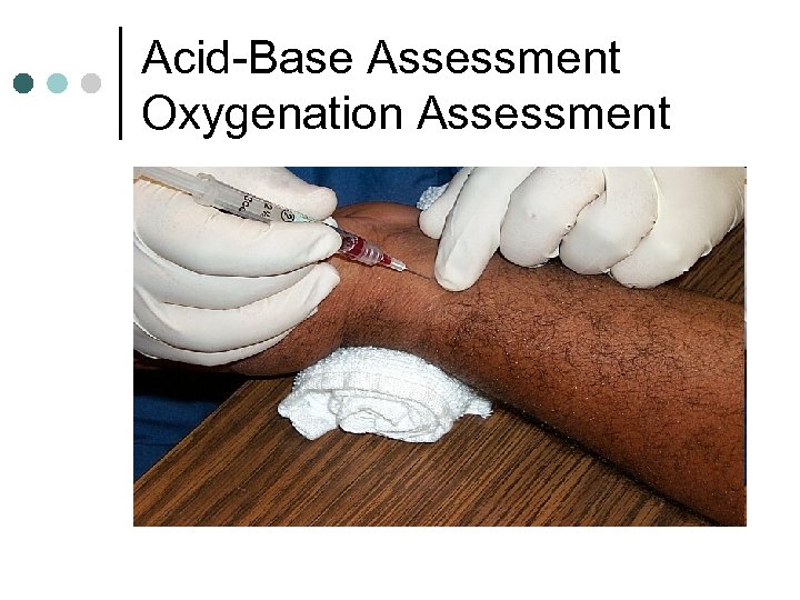 Acid-Base Assessment Oxygenation Assessment 