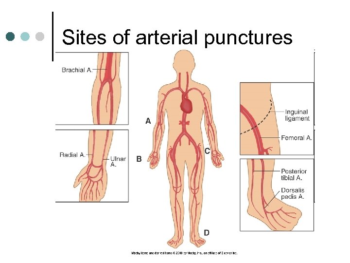 Sites of arterial punctures 