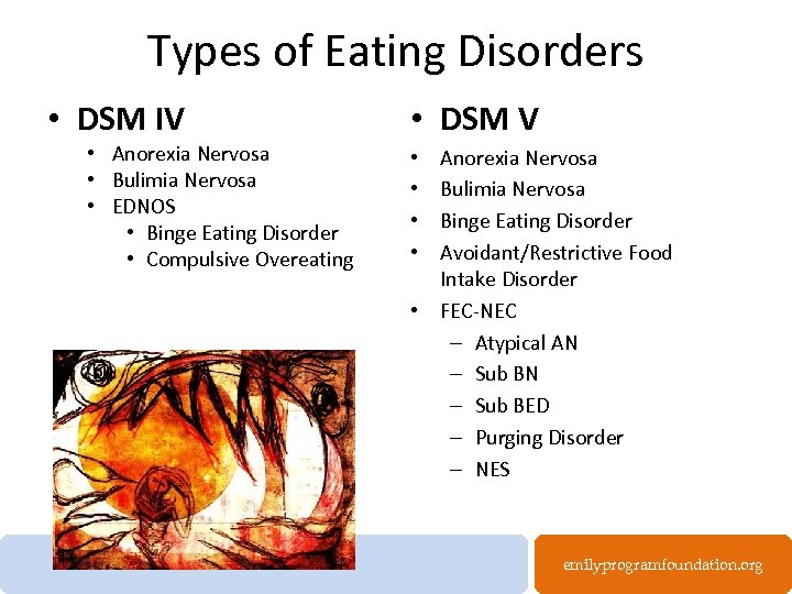 Types of Eating Disorders • DSM IV • Anorexia Nervosa • Bulimia Nervosa •