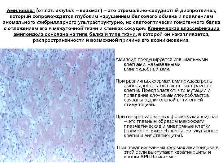 Амилоидоз (от лат. amylum – крахмал) – это стромально-сосудистый диспротеиноз, который сопровождается глубоким нарушением