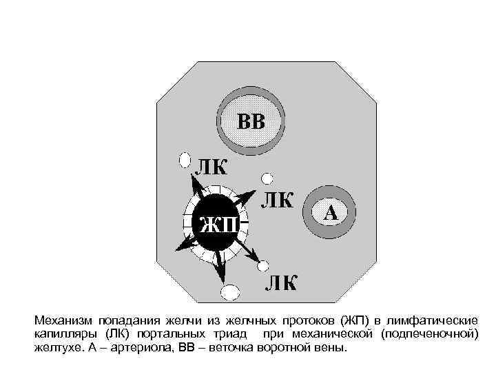 Механизм попадания желчи из желчных протоков (ЖП) в лимфатические капилляры (ЛК) портальных триад при