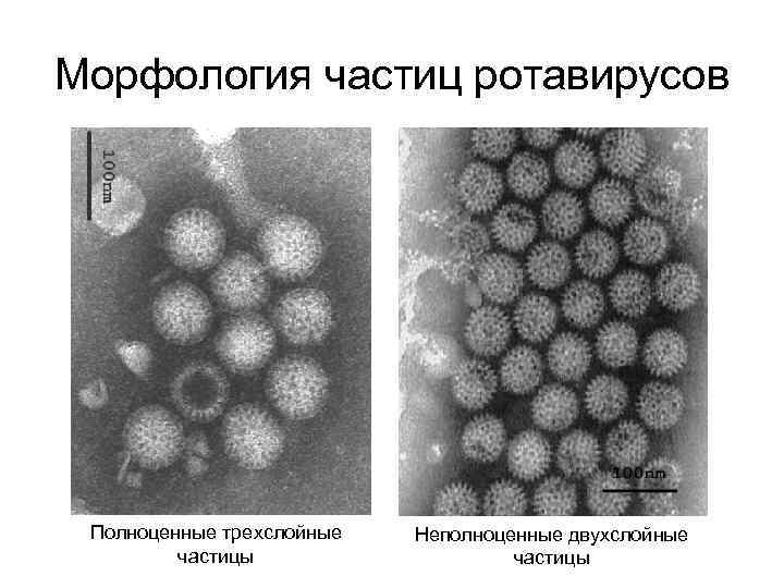 Морфология частиц ротавирусов Полноценные трехслойные частицы Неполноценные двухслойные частицы 