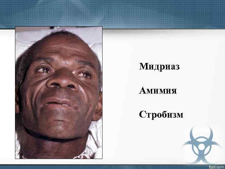 Мидриаз Амимия Стробизм 