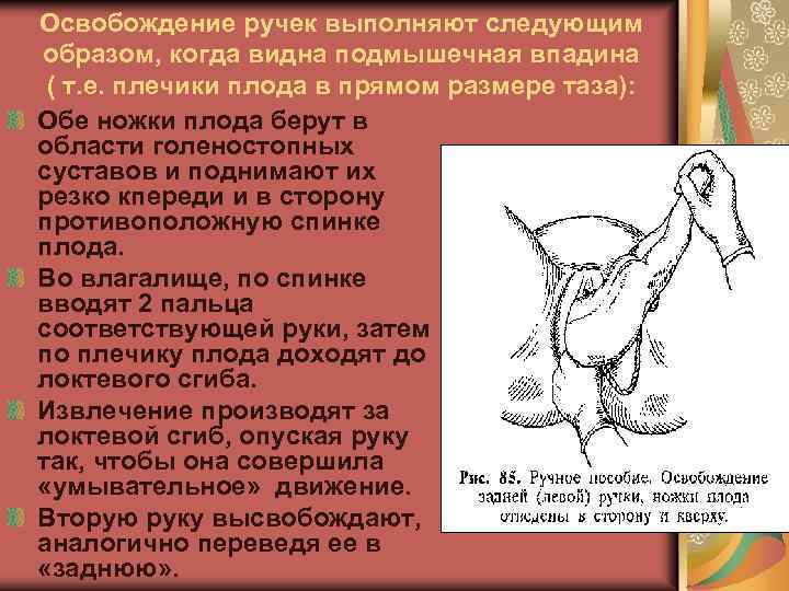 Освобождение ручек выполняют следующим образом, когда видна подмышечная впадина ( т. е. плечики плода