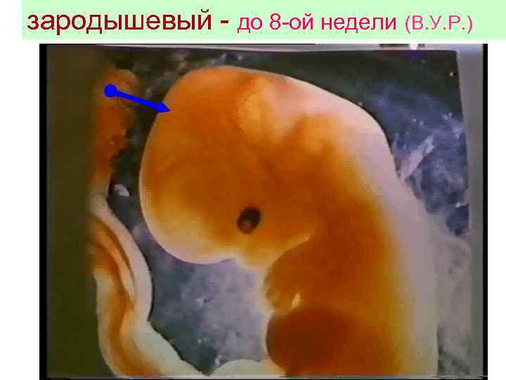 зародышевый - до 8 -ой недели (В. У. Р. ) 