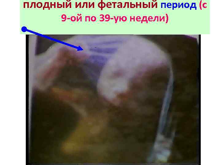 плодный или фетальный период (с 9 -ой по 39 -ую недели) 
