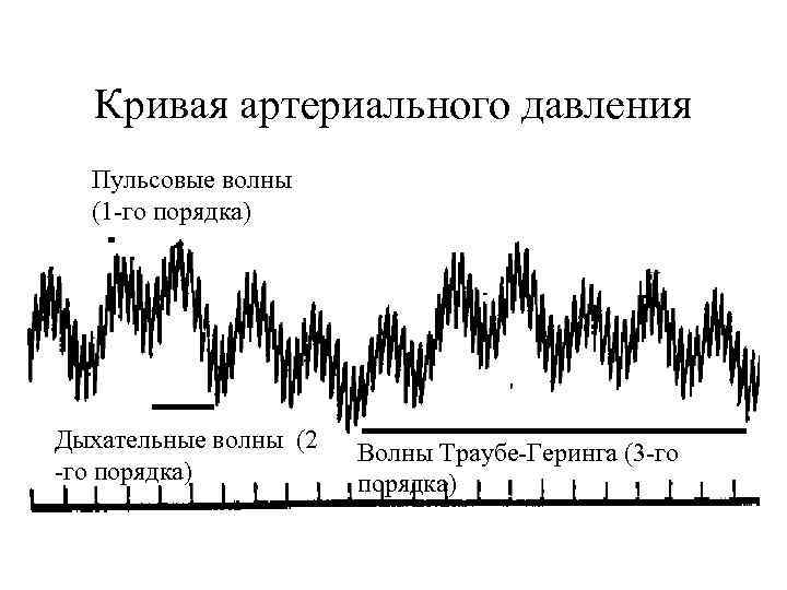 Кривая артериального давления Пульсовые волны (1 -го порядка) Дыхательные волны (2 -го порядка) Волны