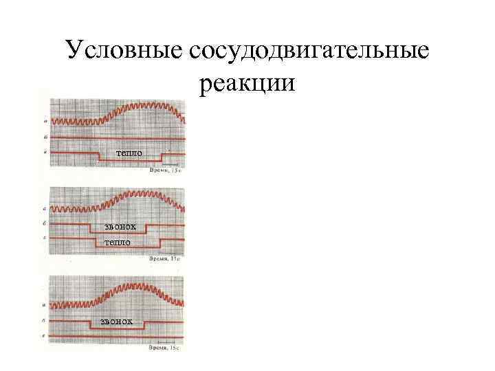 Условные сосудодвигательные реакции тепло звонок 