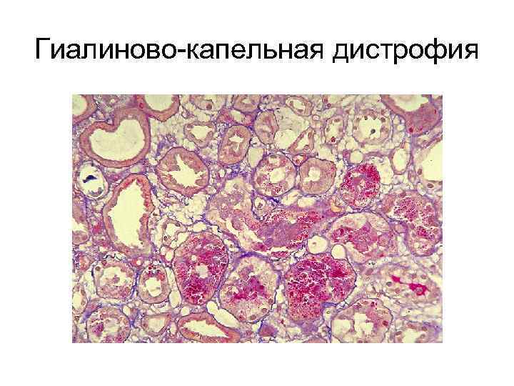 Опухоль с преобладанием паренхиматозной ткани на ощупь