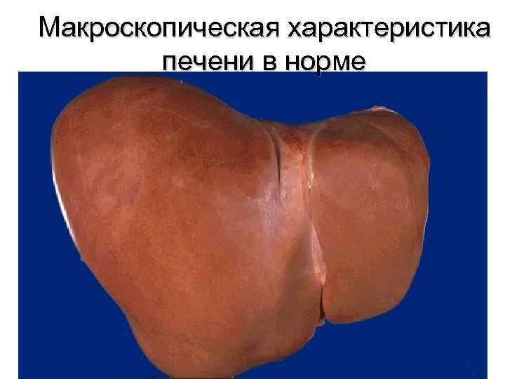 Макроскопическая характеристика печени в норме 