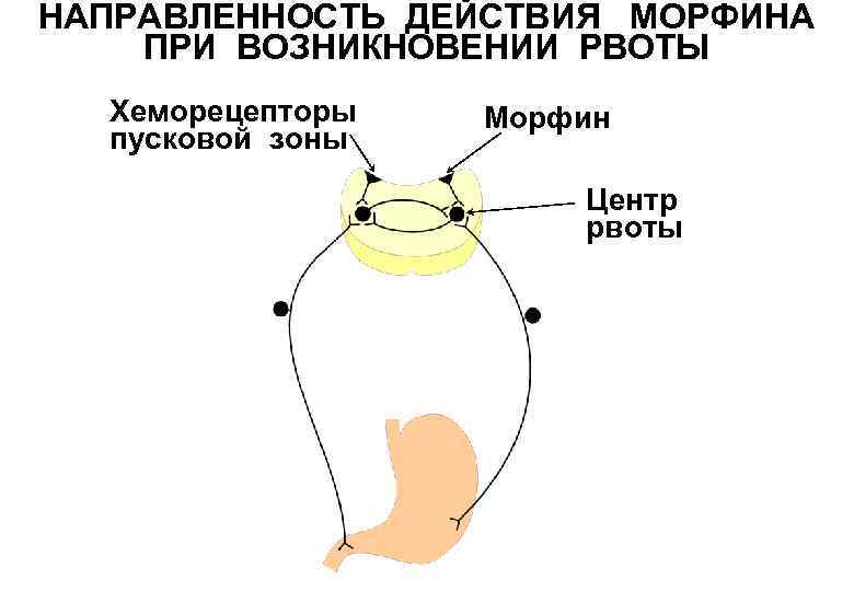 НАПРАВЛЕННОСТЬ ДЕЙСТВИЯ МОРФИНА ПРИ ВОЗНИКНОВЕНИИ РВОТЫ Хеморецепторы пусковой зоны Морфин Центр рвоты 