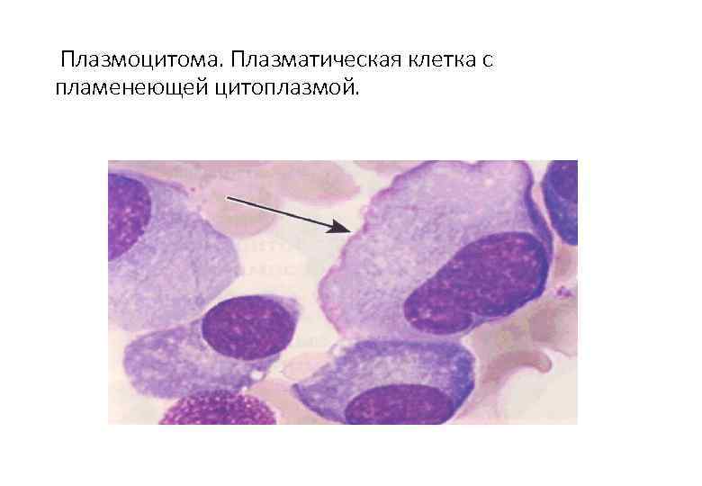 Что значит плазматические клетки