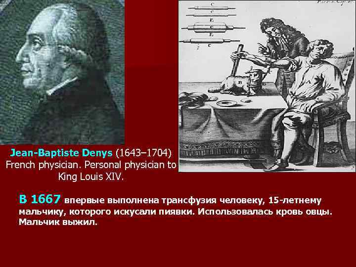 Jean-Baptiste Denys (1643– 1704) French physician. Рersonal physician to King Louis XIV. В 1667
