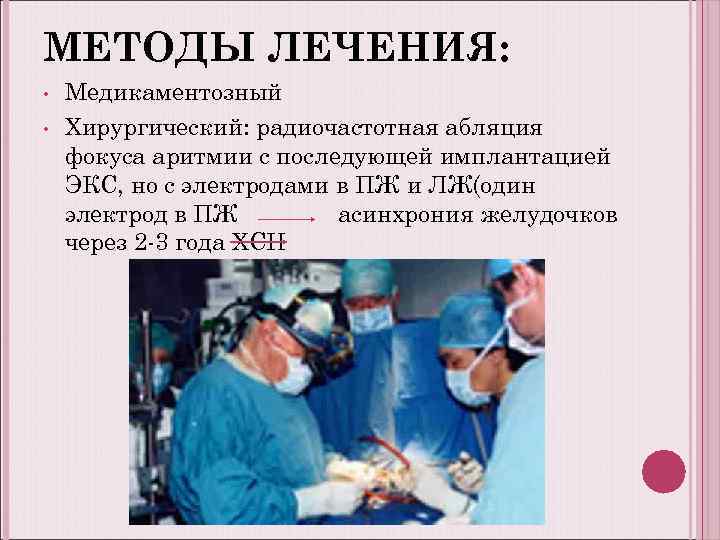 МЕТОДЫ ЛЕЧЕНИЯ: • • Медикаментозный Хирургический: радиочастотная абляция фокуса аритмии с последующей имплантацией ЭКС,
