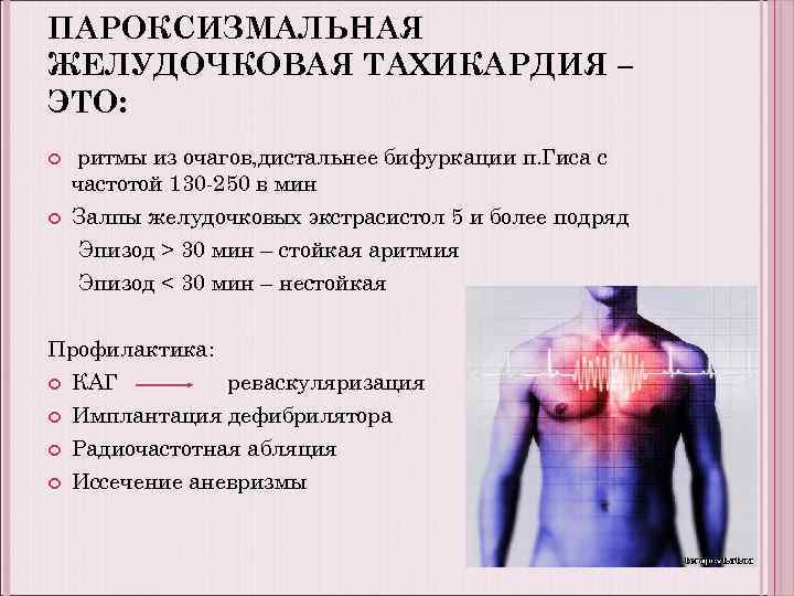 ПАРОКСИЗМАЛЬНАЯ ЖЕЛУДОЧКОВАЯ ТАХИКАРДИЯ – ЭТО: ритмы из очагов, дистальнее бифуркации п. Гиса с частотой