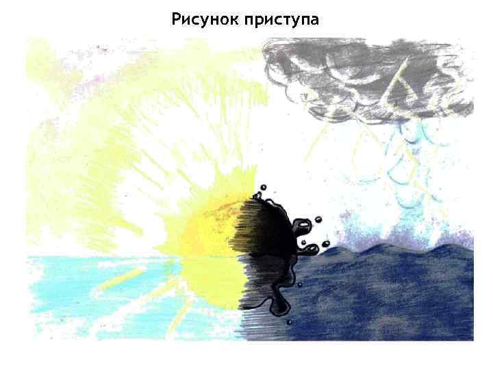 Рисунок приступа 