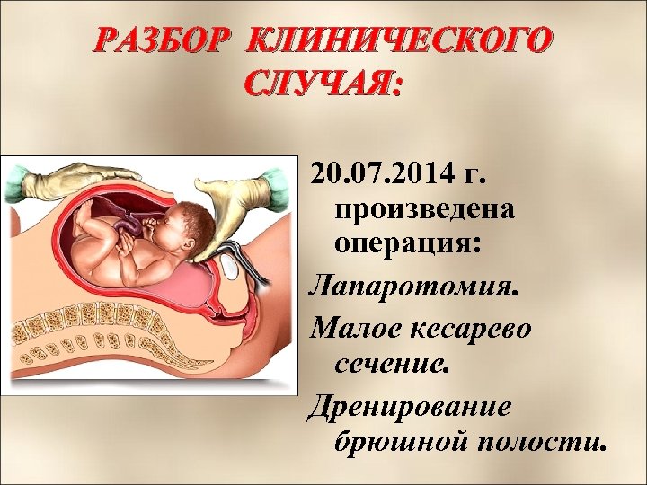 РАЗБОР КЛИНИЧЕСКОГО СЛУЧАЯ: 20. 07. 2014 г. произведена операция: Лапаротомия. Малое кесарево сечение. Дренирование