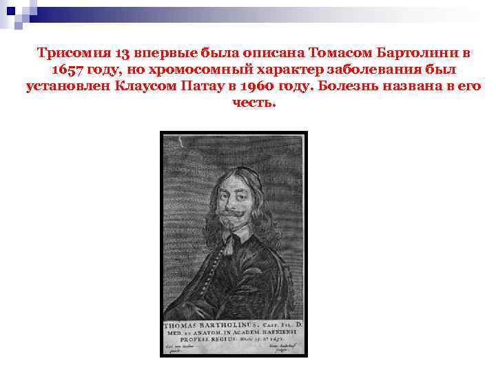 Трисомия 13 впервые была описана Томасом Бартолини в 1657 году, но хромосомный характер заболевания