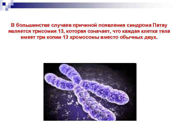 В большинстве случаев причиной появления синдрома Патау является трисомия 13, которая означает, что каждая