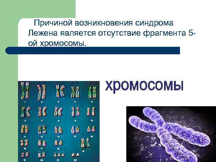 Причиной возникновения синдрома Лежена является отсутствие фрагмента 5 ой хромосомы. 