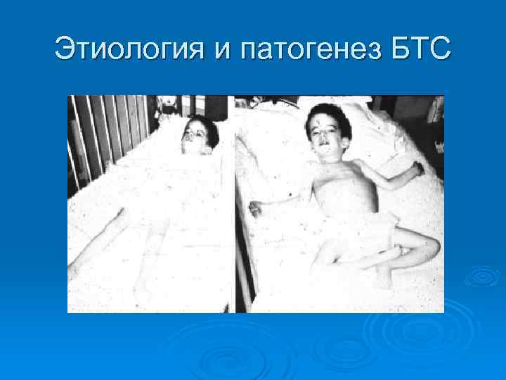 Этиология и патогенез БТС 