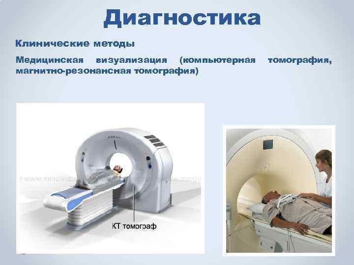 Диагностика Клинические методы Медицинская визуализация (компьютерная магнитно-резонансная томография) томография, 