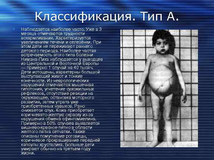 Классификация. Тип А. • Наблюдается наиболее часто. Уже в 3 месяца отмечаются трудности вскармливания.