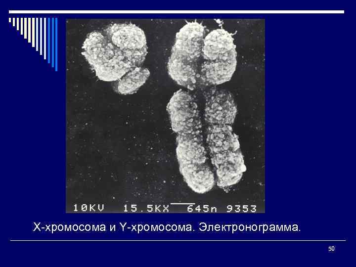 Х-хромосома и Y-хромосома. Электронограмма. 50 