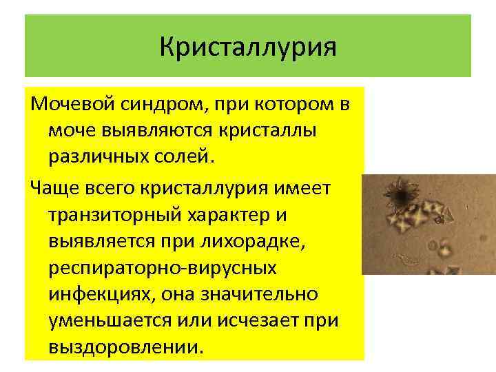 Кристаллурия Мочевой синдром, при котором в моче выявляются кристаллы различных солей. Чаще всего кристаллурия