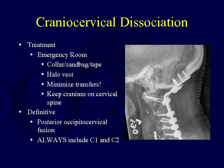 Craniocervical Dissociation • Treatment • Emergency Room • Collar/sandbag/tape • Halo vest • Minimize