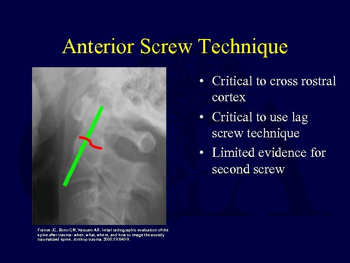 Anterior Screw Technique • Critical to cross rostral cortex • Critical to use lag