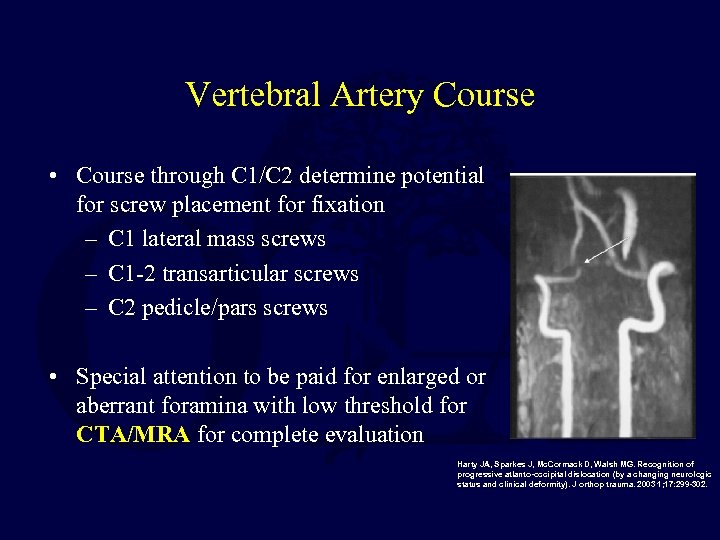 Vertebral Artery Course • Course through C 1/C 2 determine potential for screw placement