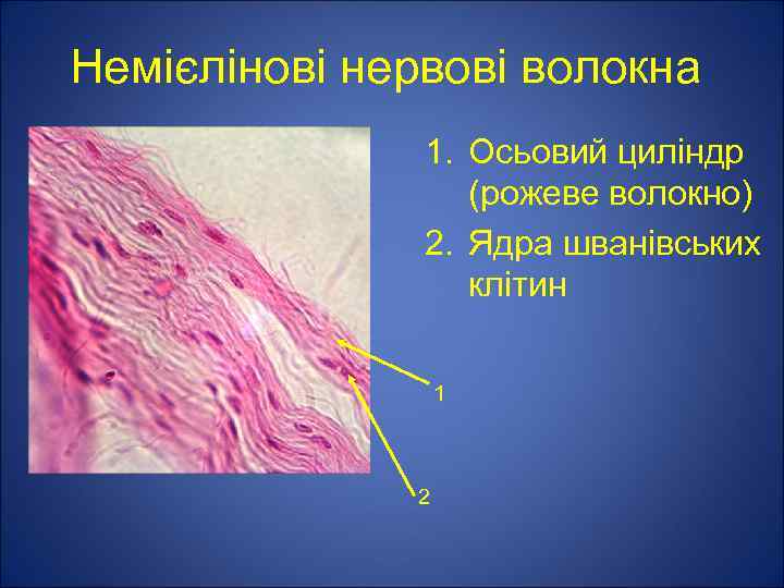 Немієлінові нервові волокна 1. Осьовий циліндр (рожеве волокно) 2. Ядра шванівських клітин 1 2