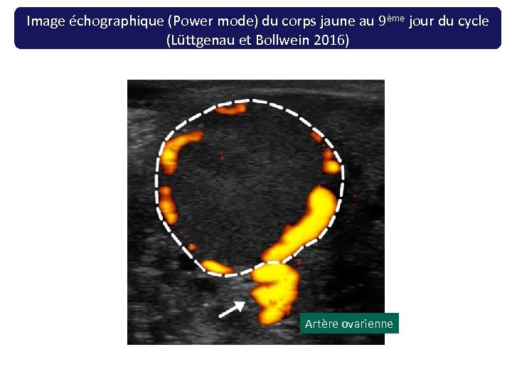 Image échographique (Power mode) du corps jaune au 9ème jour du cycle (Lüttgenau et