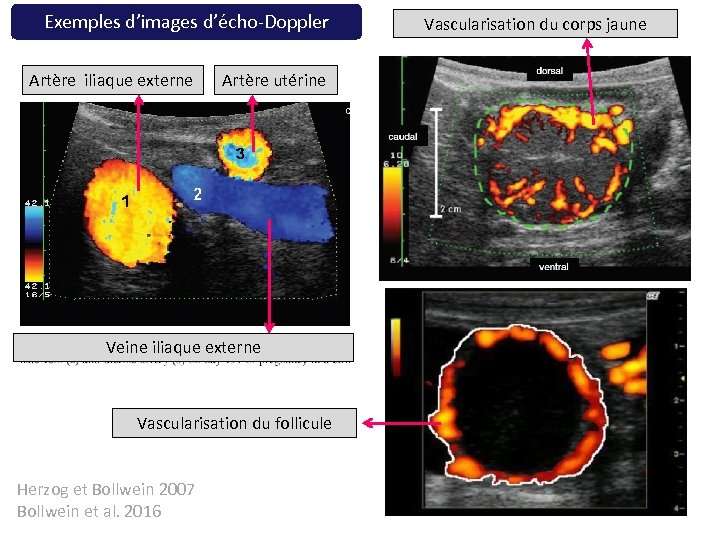 Exemples d’images d’écho-Doppler Artère iliaque externe Artère utérine Veine iliaque externe Vascularisation du follicule