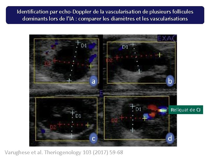 Identification par echo-Doppler de la vascularisation de plusieurs follicules dominants lors de l’IA :