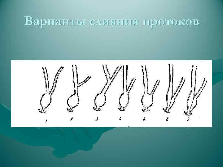 Варианты слияния протоков 