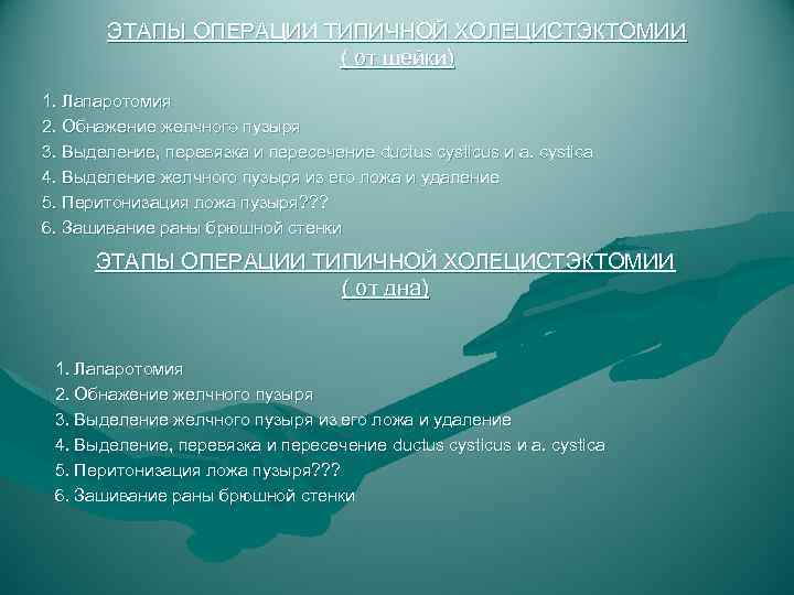 ЭТАПЫ ОПЕРАЦИИ ТИПИЧНОЙ ХОЛЕЦИСТЭКТОМИИ ( от шейки) 1. Лапаротомия 2. Обнажение желчного пузыря 3.