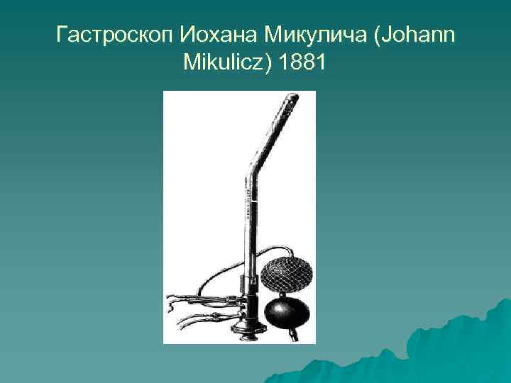 Гастроскоп Иохана Микулича (Johann Mikulicz) 1881 