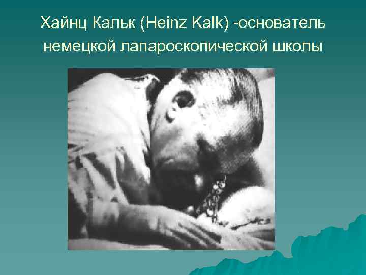 Хайнц Кальк (Heinz Kalk) -основатель немецкой лапароскопической школы 