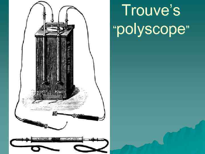 Trouve’s “polyscope” 