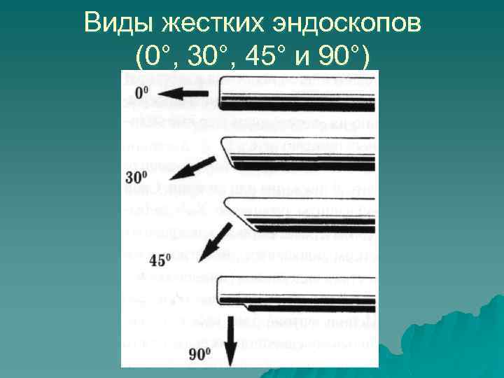 Виды жестких эндоскопов (0°, 30°, 45° и 90°) 