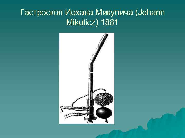 Гастроскоп Иохана Микулича (Johann Mikulicz) 1881 