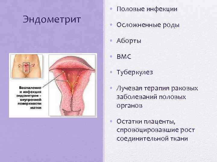 Эндометрит • Половые инфекции • Осложненные роды • Аборты • ВМС • Туберкулез •